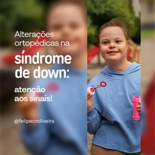 Alterações ortopédicas na síndrome de Down